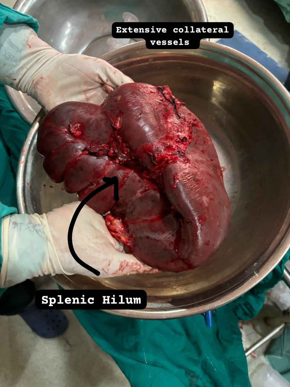 Hepatobiliary Surgery