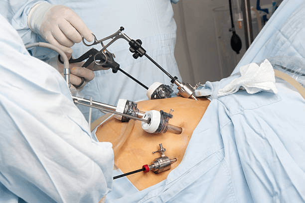 Minimally Invasive Surgery